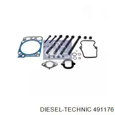 A5410101621 Mercedes Комплект прокладок двигателя верхний