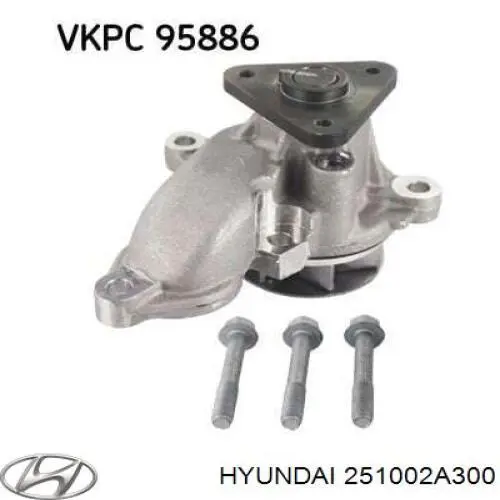 Помпа 251002A300 Hyundai/Kia