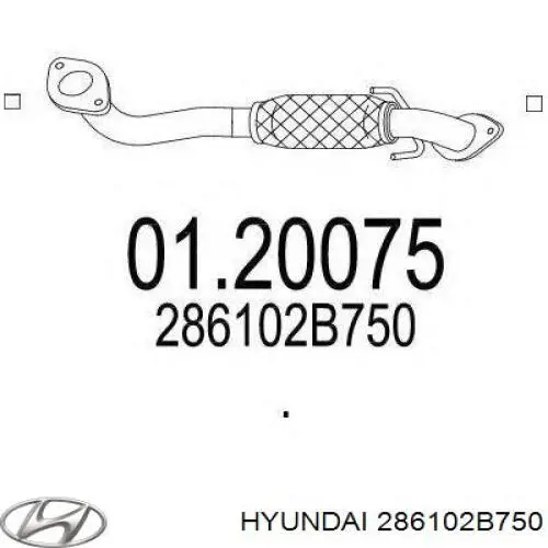 286102B750 Hyundai/Kia tubo de admissão dianteiro (calças do silenciador)