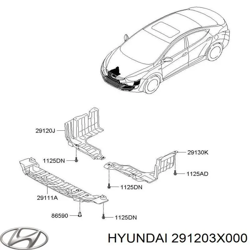 Защита двигателя правая на Hyundai Elantra MD