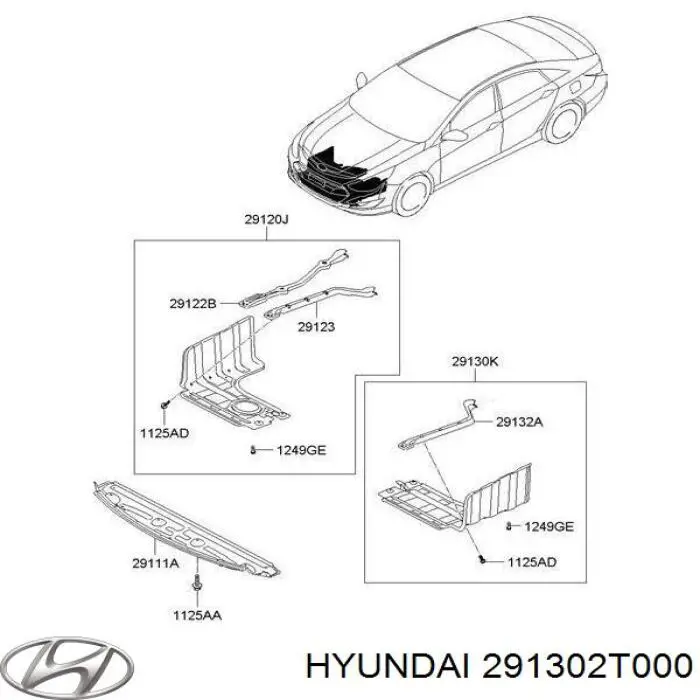 291302T000 Hyundai/Kia proteção de motor esquerdo