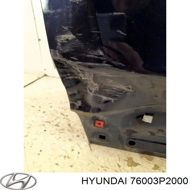  76003P2000 Hyundai/Kia