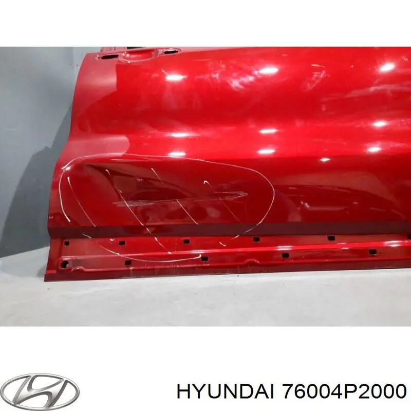 76004P2000 Hyundai/Kia 