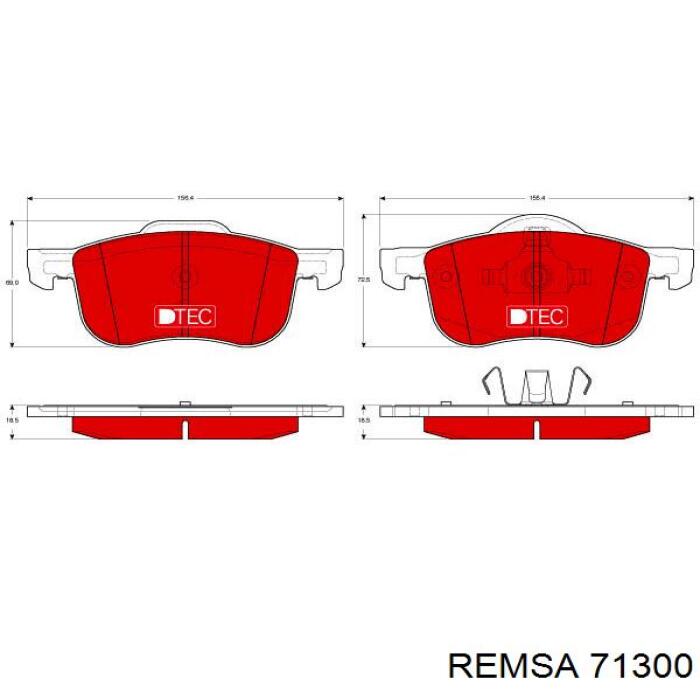 71300 Remsa колодки тормозные передние дисковые