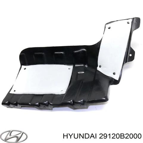 HYUNDAI 29120B2000 Защита двигателя правая в наличии Украина