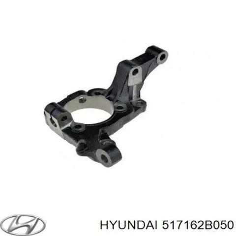 517162B050 HYUNDAI Цапфа передняя правая купить в Павлоград
