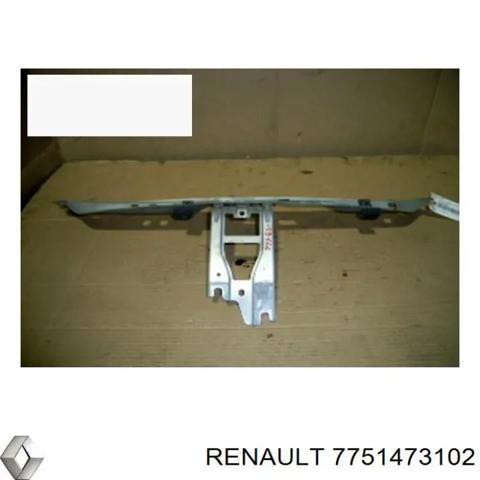 Оперение в сборе 7751473102 RENAULT