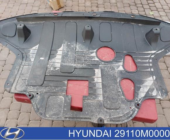 Защита картера двигателя 29110M0000 HYUNDAI