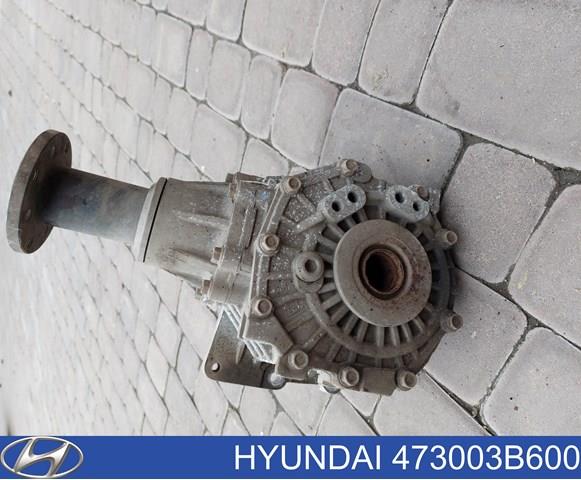 Раздатка (коробка раздаточная) Hyundai Santa Fe 3