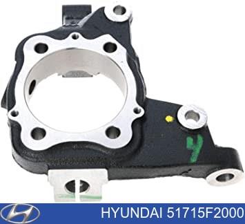 Цапфа поворотная левая 51715F2000 HYUNDAI