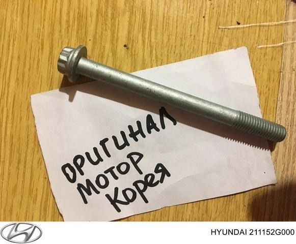 Насос системы охлаждения 211152G000 HYUNDAI