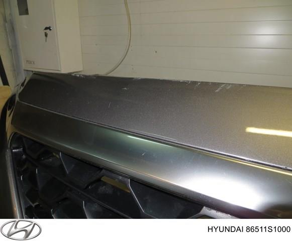 Купить 86375S1030 Hyundai/Kia 