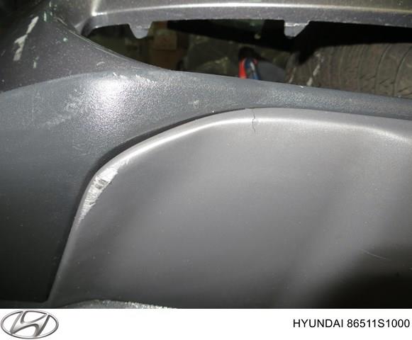 86577S1000 Hyundai/Kia Обвес бампера